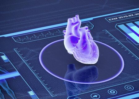 هوش مصنوعی با بررسی عکس رادیولوژی حمله قلبی را پیش‌بینی می‌کند